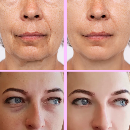 Face Sculpting Beauty Roller™